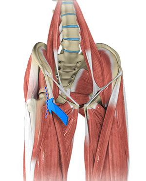 Minimally Invasive Direct Anterior Approach